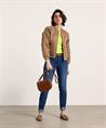 Rosner Skinny-Jeans Reißverschlüsse Audrey 1